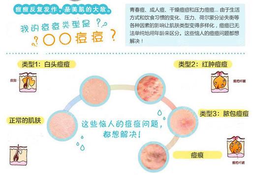 最新痤瘡治療方法探索，高效安全解決方案